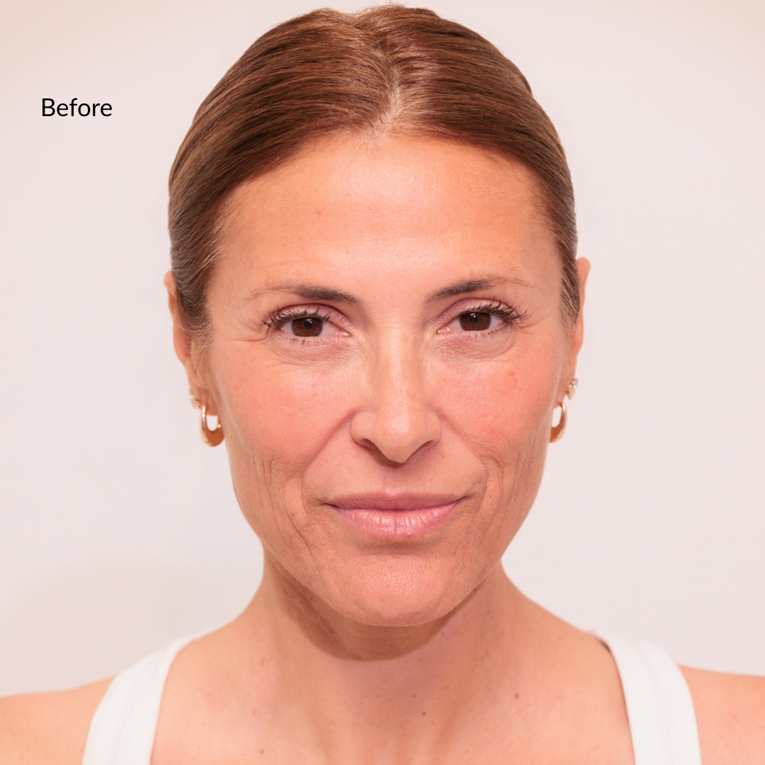 Anti-Redness Colour Corrector with SPF 30