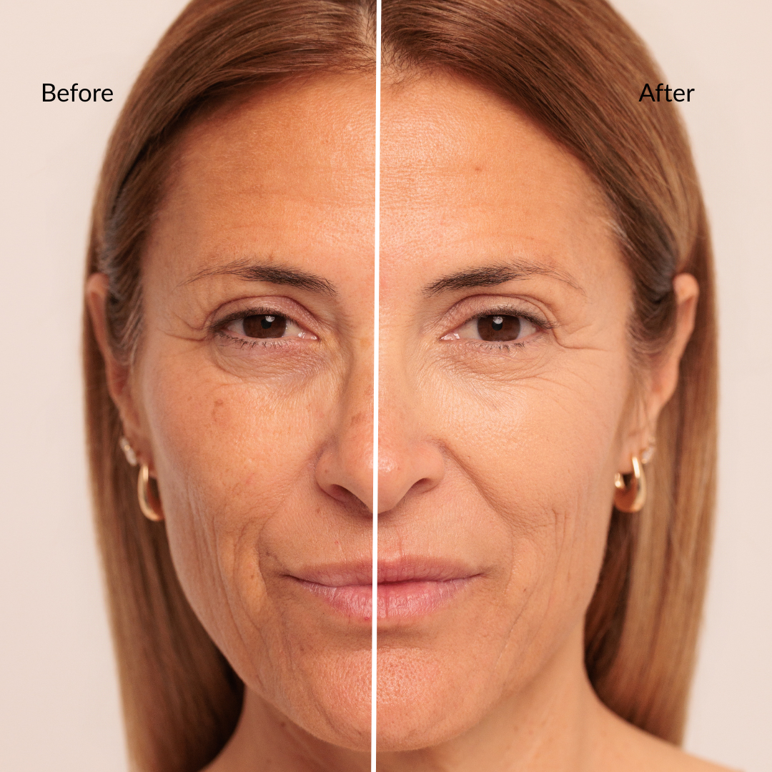 Instant Under Eye Concealer